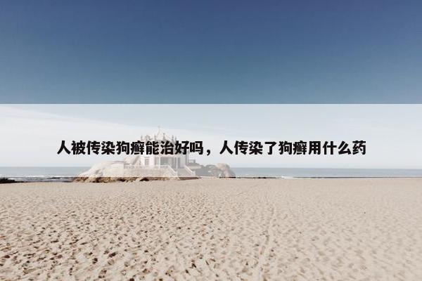 人被传染狗癣能治好吗，人传染了狗癣用什么药